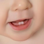 Baby Bottom Teeth V Shape: What to Know