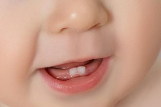 Baby Bottom Teeth V Shape: What to Know