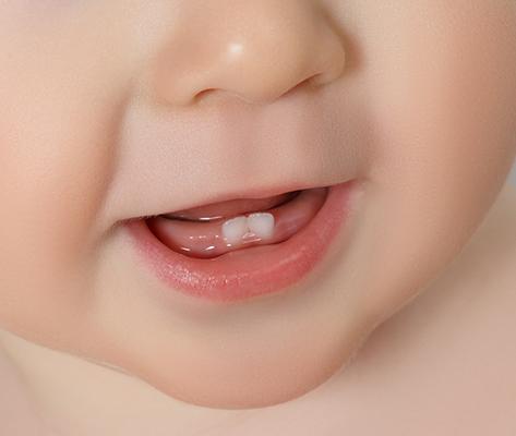 Baby Bottom Teeth V Shape: What to Know